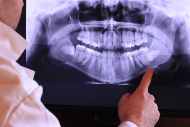 Best Same-Day Emergency Dentist in Lookout Mountain, AL