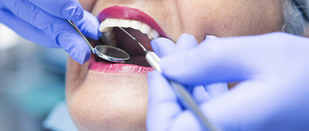 Best Emergency Treatment for Toothache in Lookout Mountain, AL